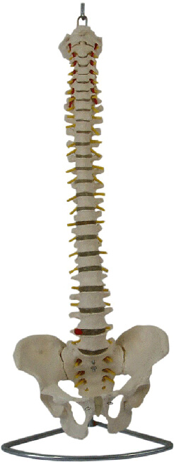 Fusão Espinhal