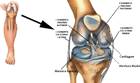 Lesão do Ligamento Cruzado Anterior
