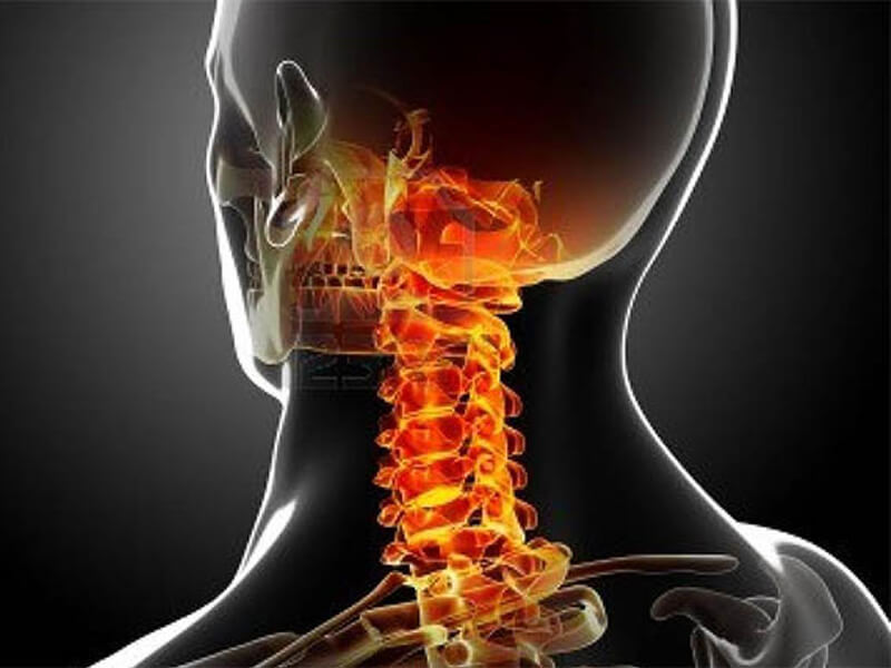 Cervicalgia