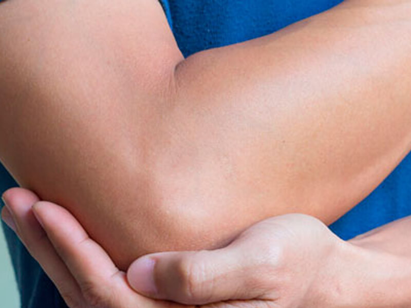 Osteoartrite do Cotovelo