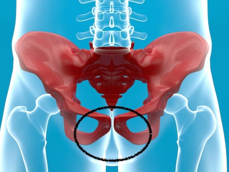 Pubalgia