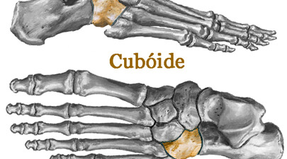 O que é a Síndrome do Cuboide?