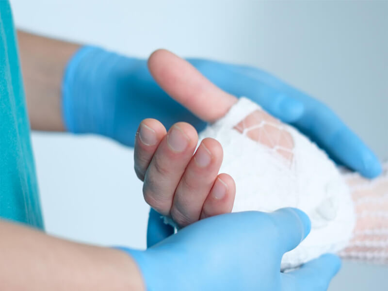 Cirurgia na Mão